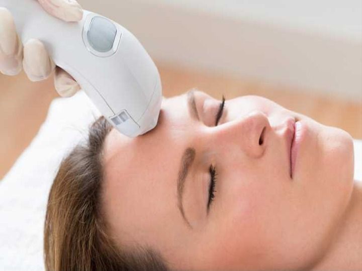 8 Tips for a Successful Laser Pigmentation Treatment