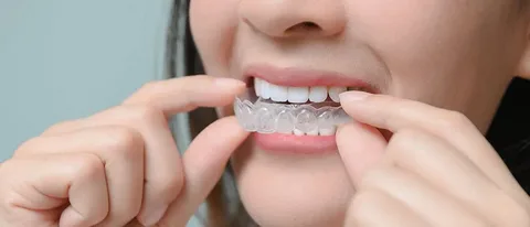 Invisalign Success Stories — Real Results from London Patients